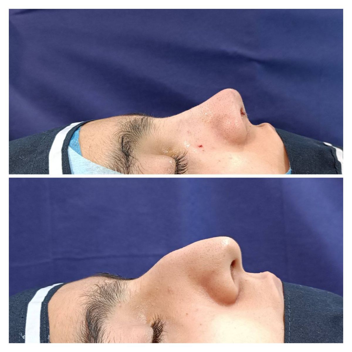 بهترین جراح زیبایی بینی در مشهد